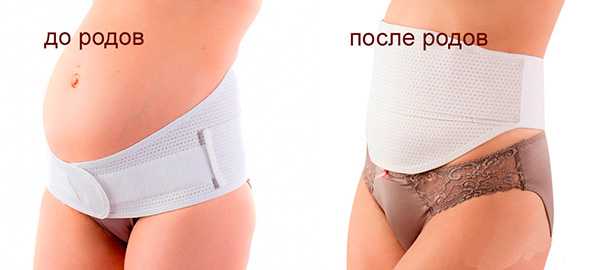 Универсальный бандаж, который можно носить как во время беременности, так и после.