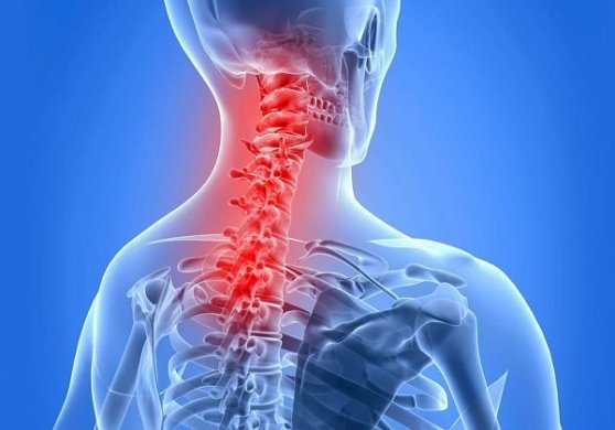Остеохондроз шейного отдела: причины, симптомы и методы лечения
